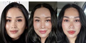 Setelah satu bulan, Titi DJ membagikan potret terbaru wajahnya yang telah melalukan operasi anti aging. (@ti2dj)